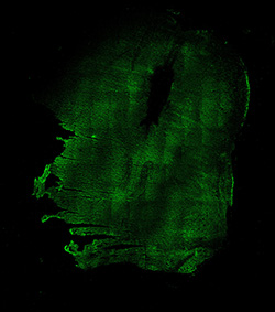 13PCW human midbrain